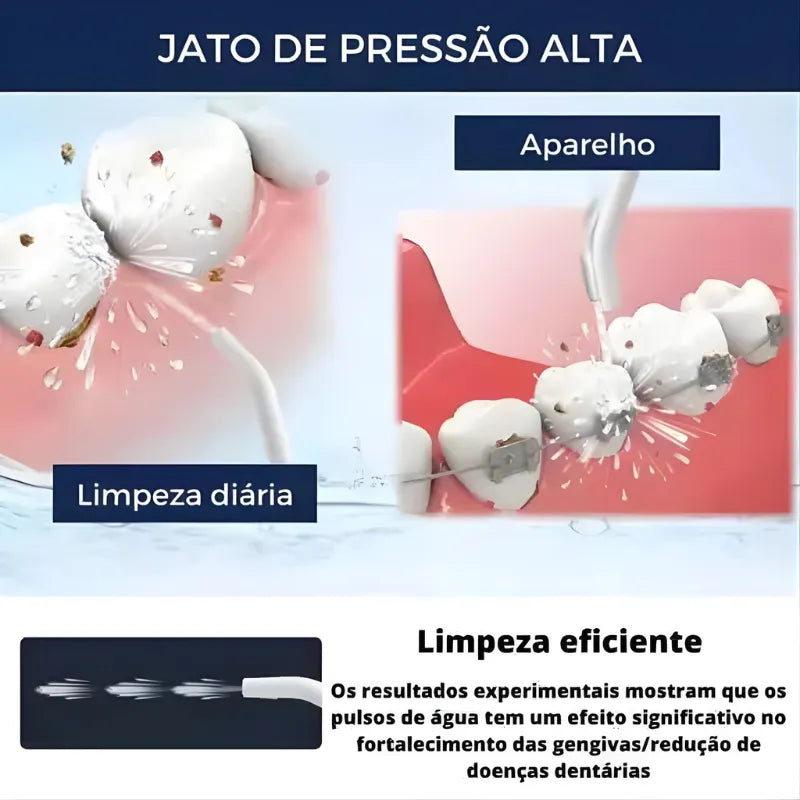 Irrigador Oral Portátil DentalJet™ - Higiene Bucal Profunda e Eficiente