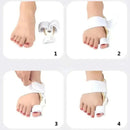 Corretor Ortopédico de Joanete - OrthoStep™